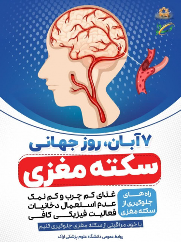 ۷ آبان، روز جهانی سکته مغزی